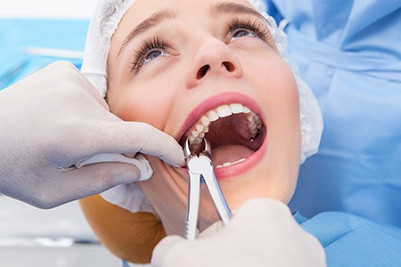 teeth extraction