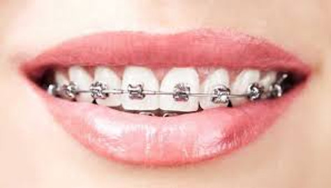 orthodontics